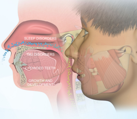 Træning i TMJ, SDB og Myofunktionelle forstyrrelser