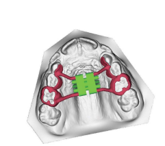 CAD-CAM - Ortodonti Service A/S