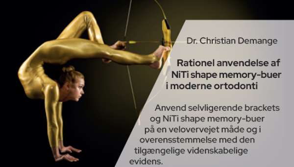 Rationel anvendelse af NiTi shape memory-buer i moderne ortodonti