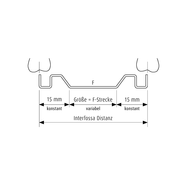 TopJet palate arch size 4, 18mm
