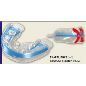 T3 MYOBRACE FOR TEENS SIZE 1