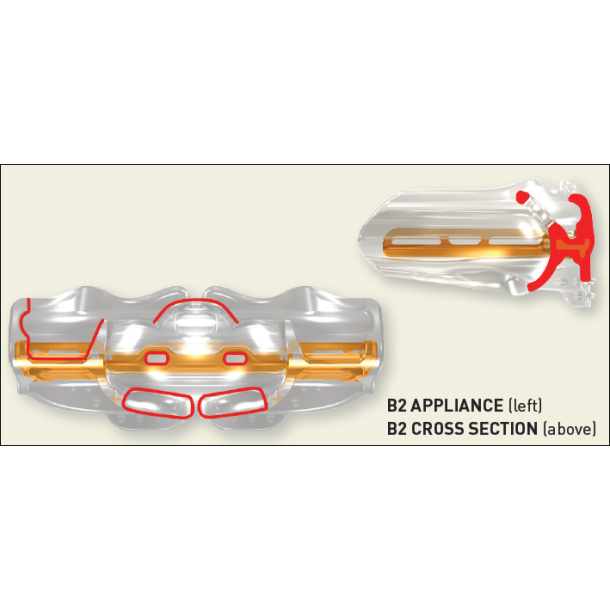 B2 MYOBRACE FOR BRACES MEDIUM CLEAR