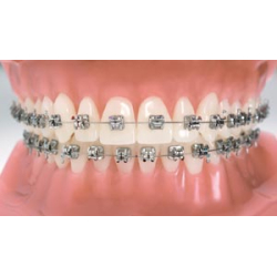 BIOQUICK BRACKET KITS 5-5