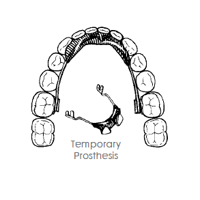3 D WILSON DYS MODULE TRU-CHROME
