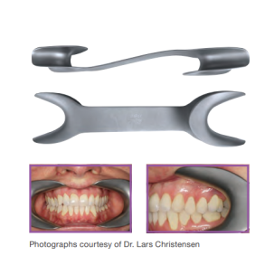 Stainless Steel Cheek Retractor