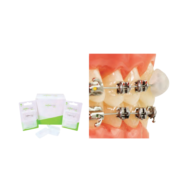 Ortho Ease WAX