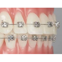 MINI SPRINT II  KITS 5-5