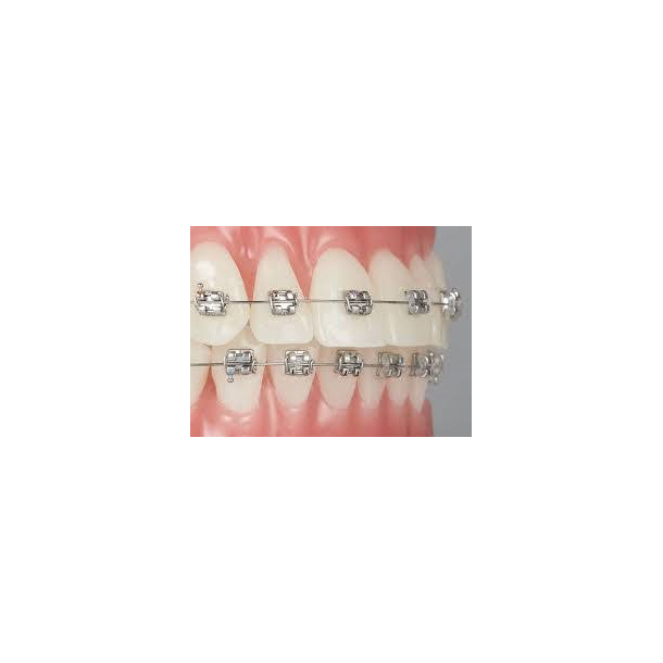 MINI SPRINT II  KITS 5-5