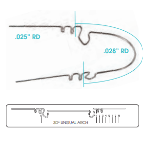 3D LINGUAL ARCH Wilson