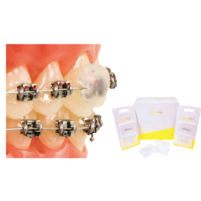 Ortho Ease Silicone white