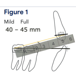 Ealstic Selector Gauge