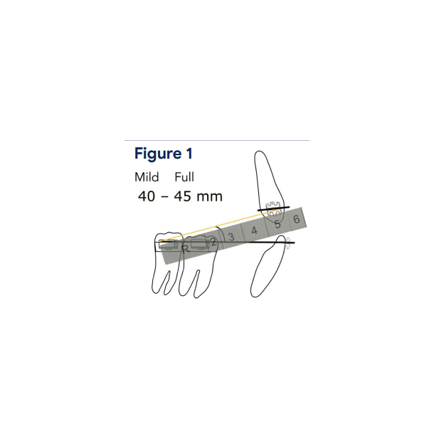 Ealstic Selector Gauge